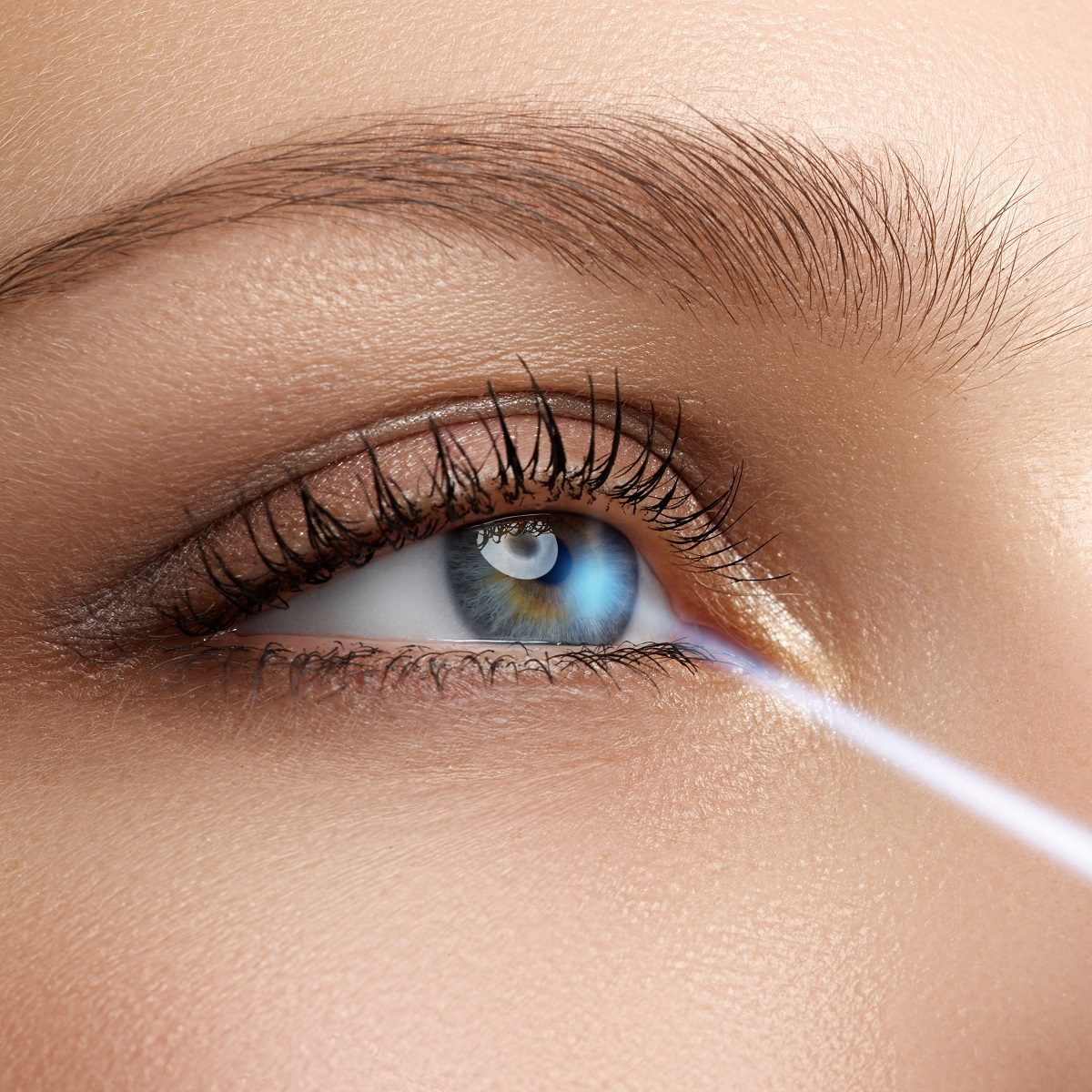 Comfortable LASIK procedure in La Jolla